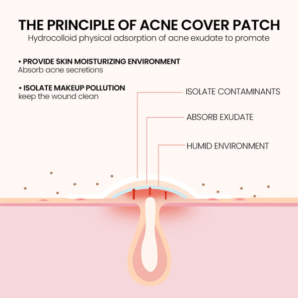 Pimple Patches,Pimple Patches For Face, Hydrocolloid Acne Patches, Cute Star Stickers Hydrocolloid Acne Pimple Patch For Covering Zits And Blemishes - Image 5